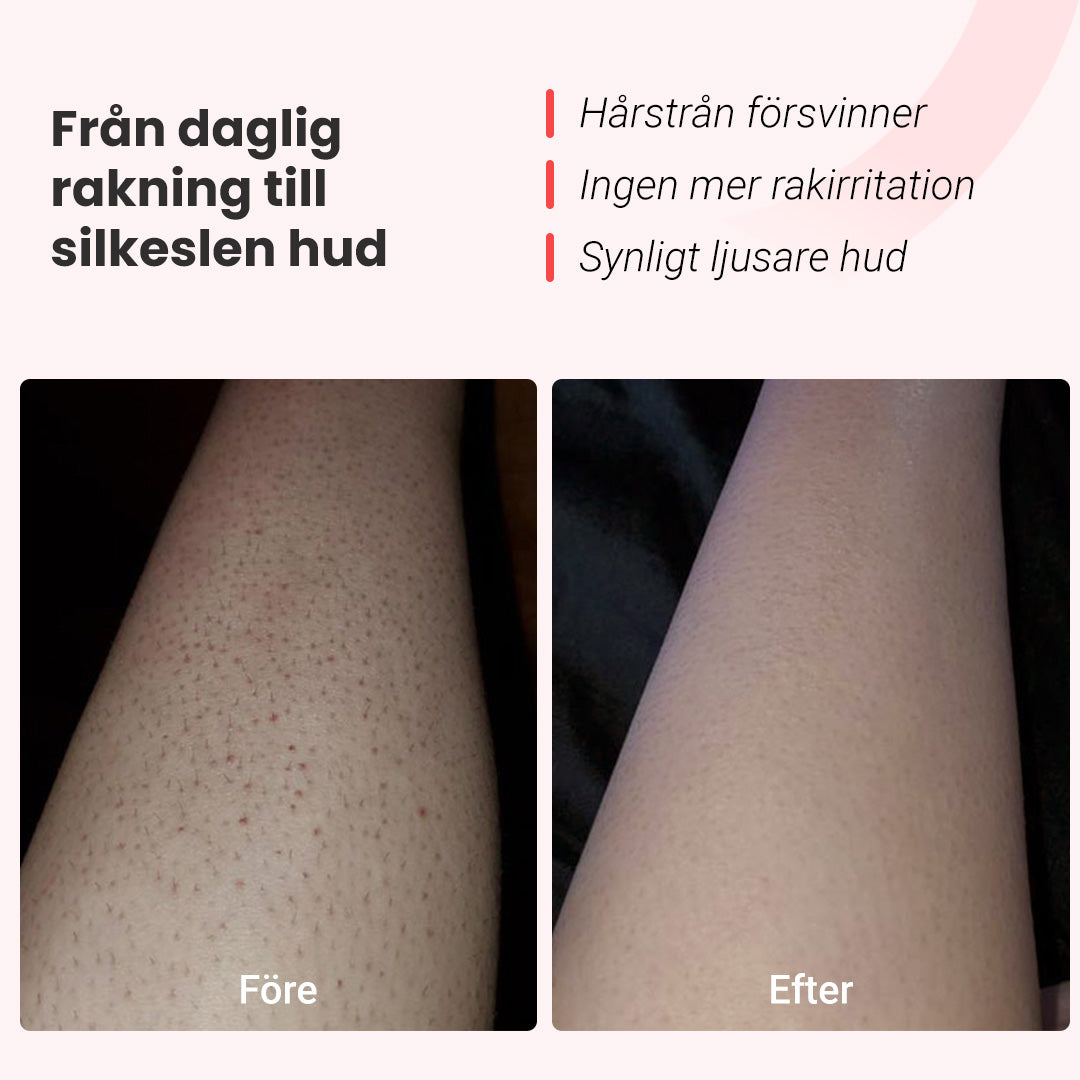 IPL Hårborttagare